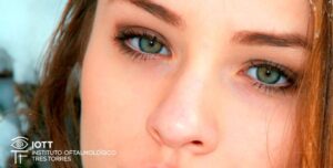 mirada belleza blefaroplastia oculoplastia